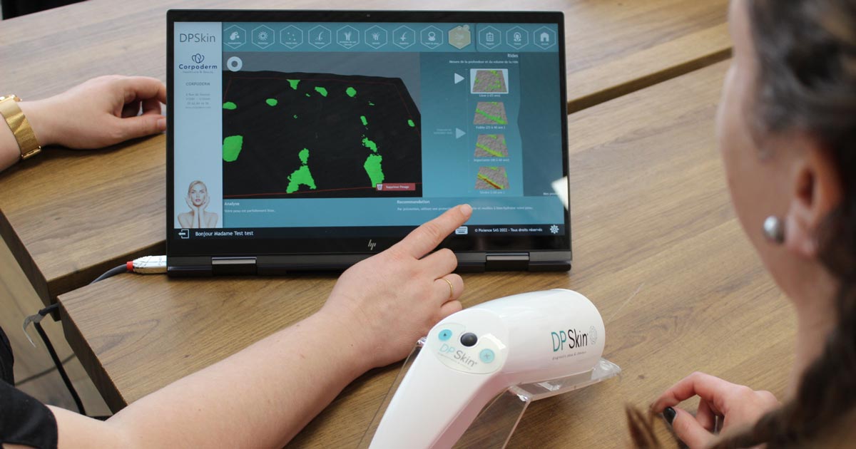 affichage des résultats du diagnostic de peau IA