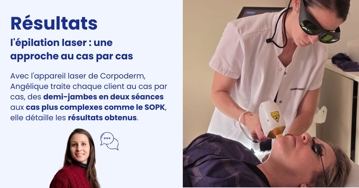 vignette expertise épilation laser diode visage et corps