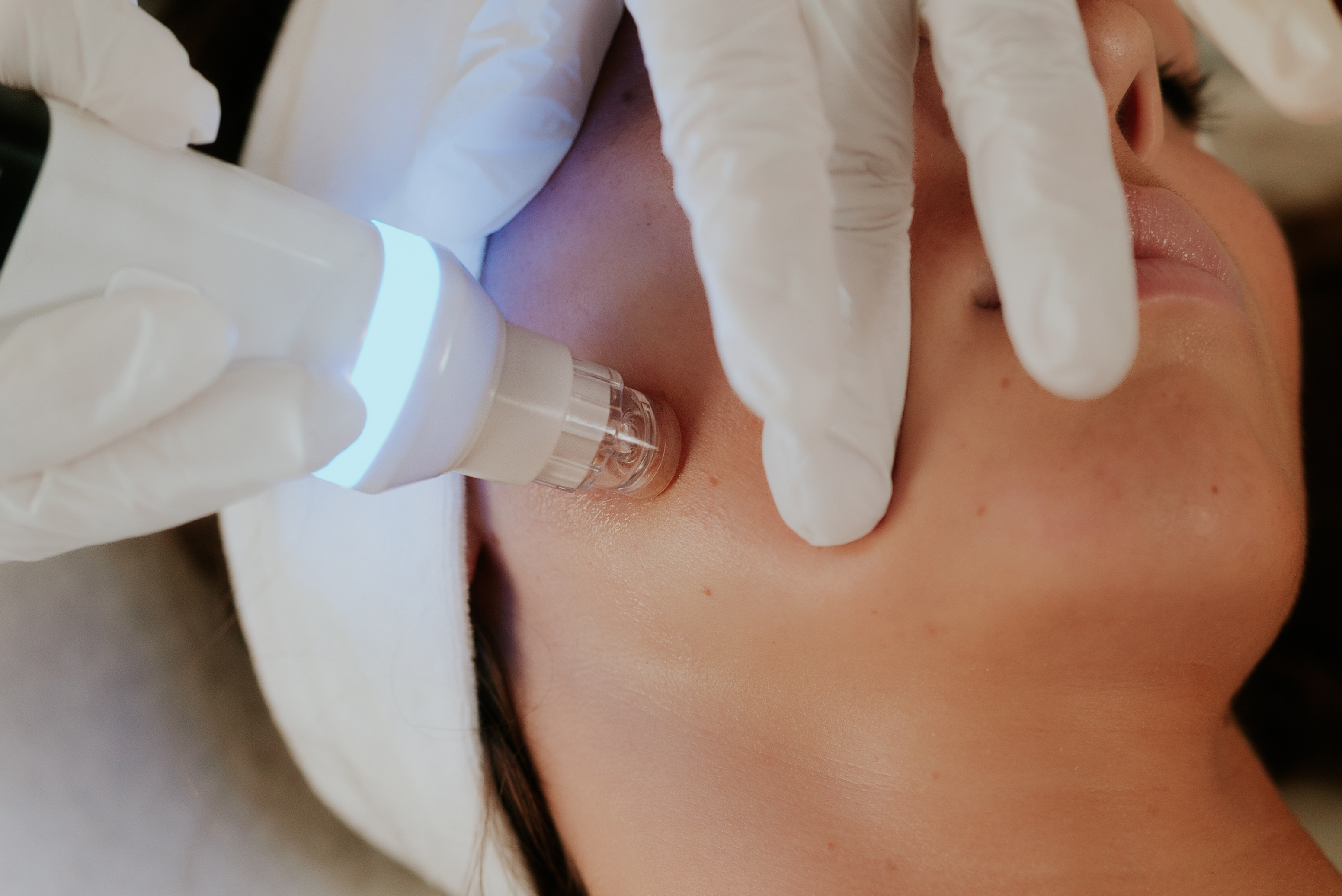 soin hydradermabrasion avec l'appareil visage Esthéskin