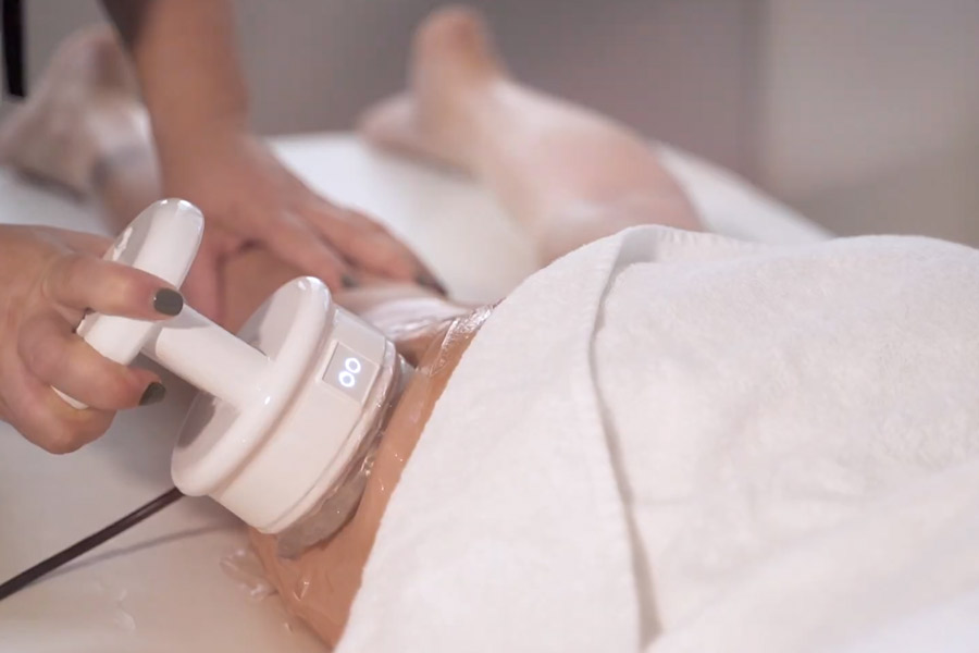 traitement de la cellulite avec Adipologie