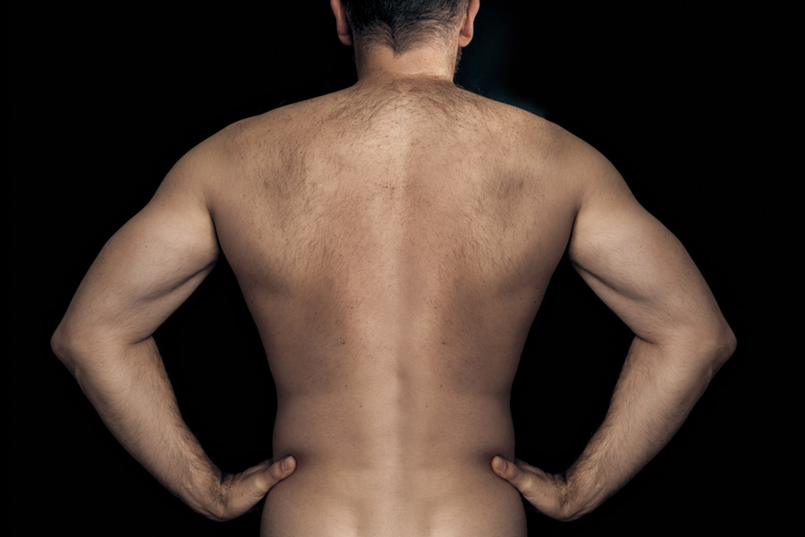 étude de cas : épilation dorsale