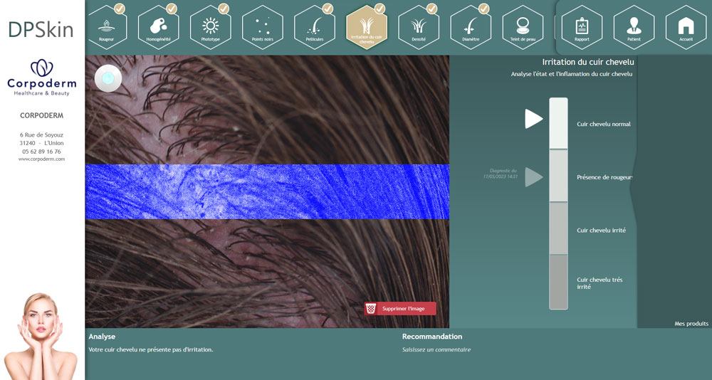 Analyse du cuir chevelu et recommandations