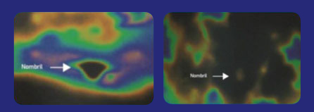 aspect adiposité durcie par thermographie