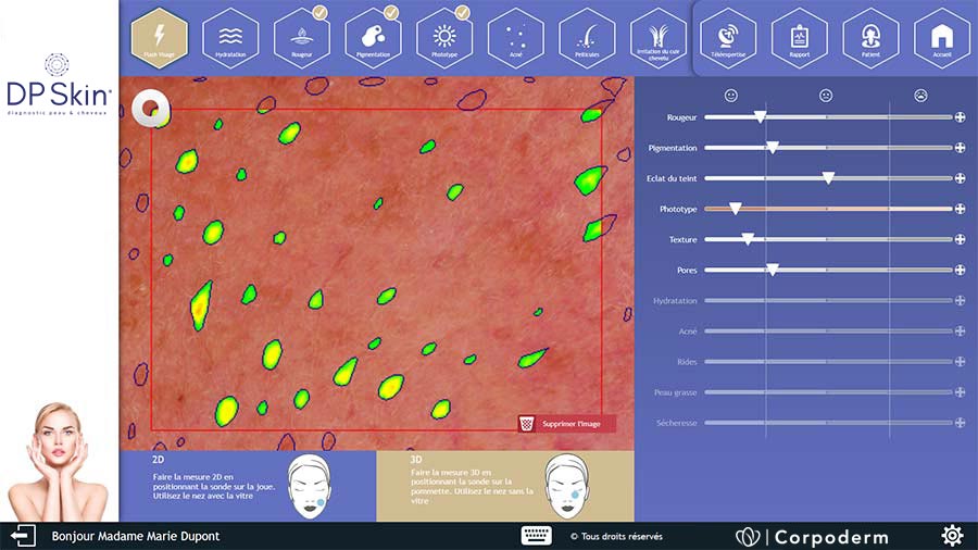 peau observée avec un dermascope professionnel
