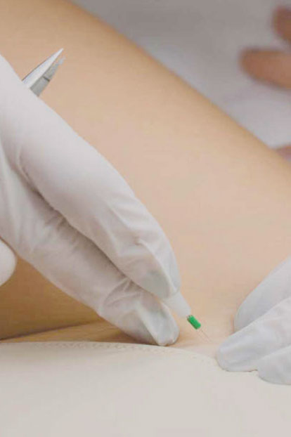 épilation thermolyse du maillot