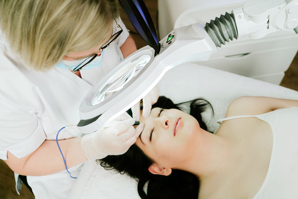 épilation du visage par thermolyse