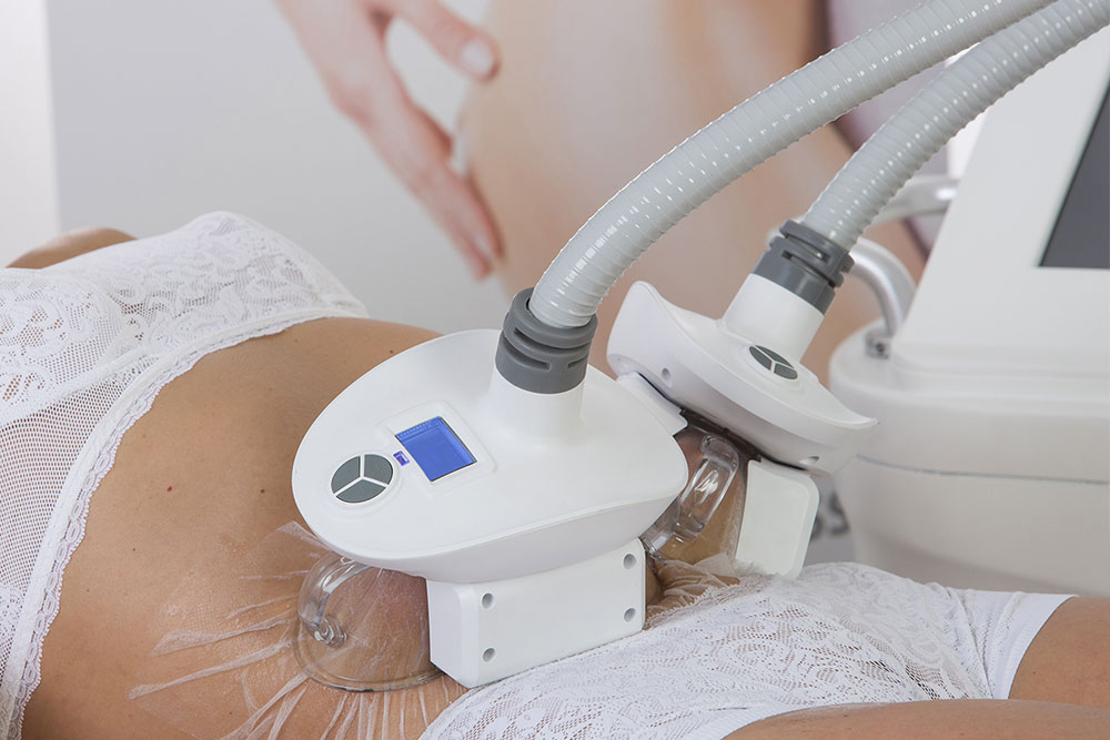 Application de la cryolipolyse ventre
