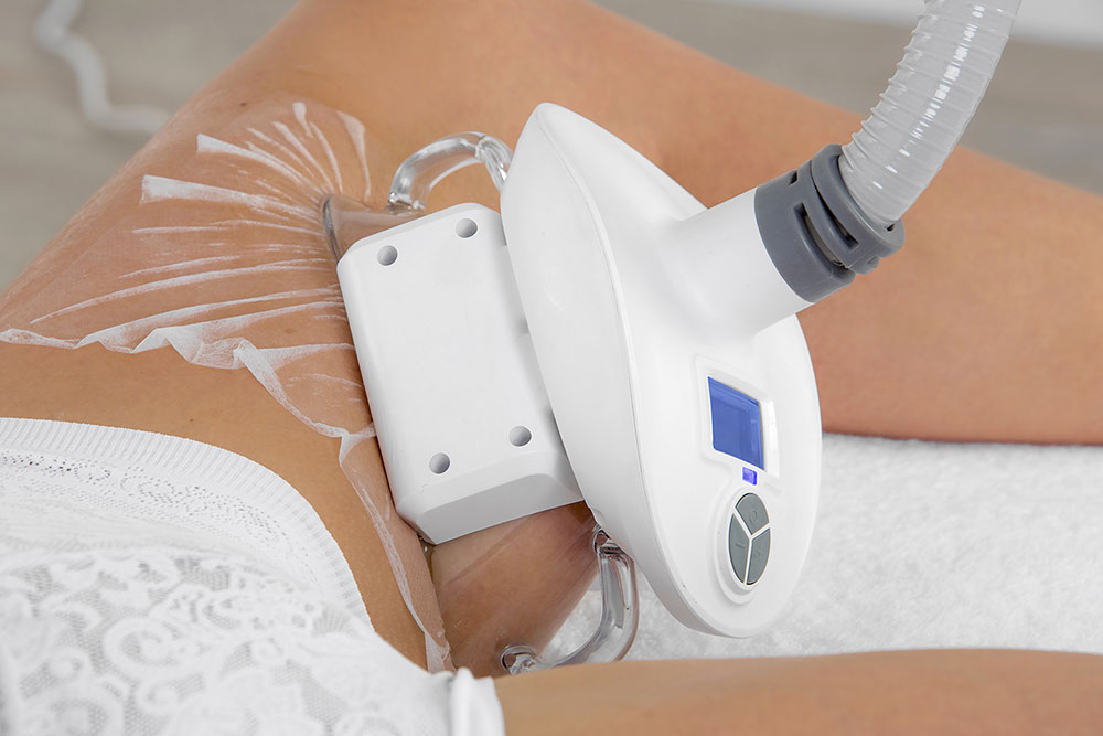 Traitement minceur des cuisses par cryolipolyse