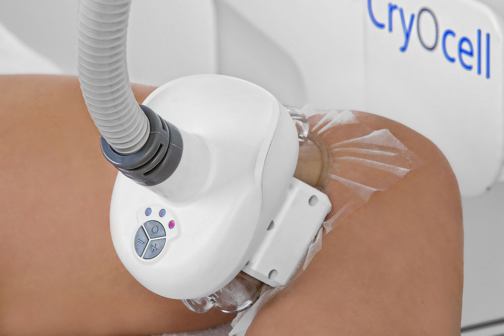 Cryolipolyse des amas graisseux intérieur des genoux