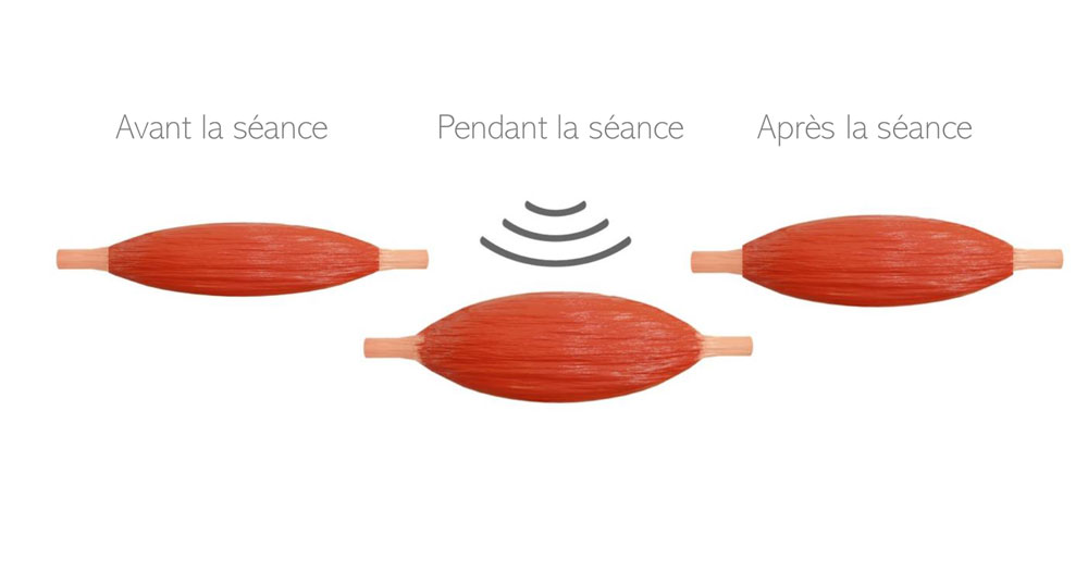 avant pendant après soin électrostimulation