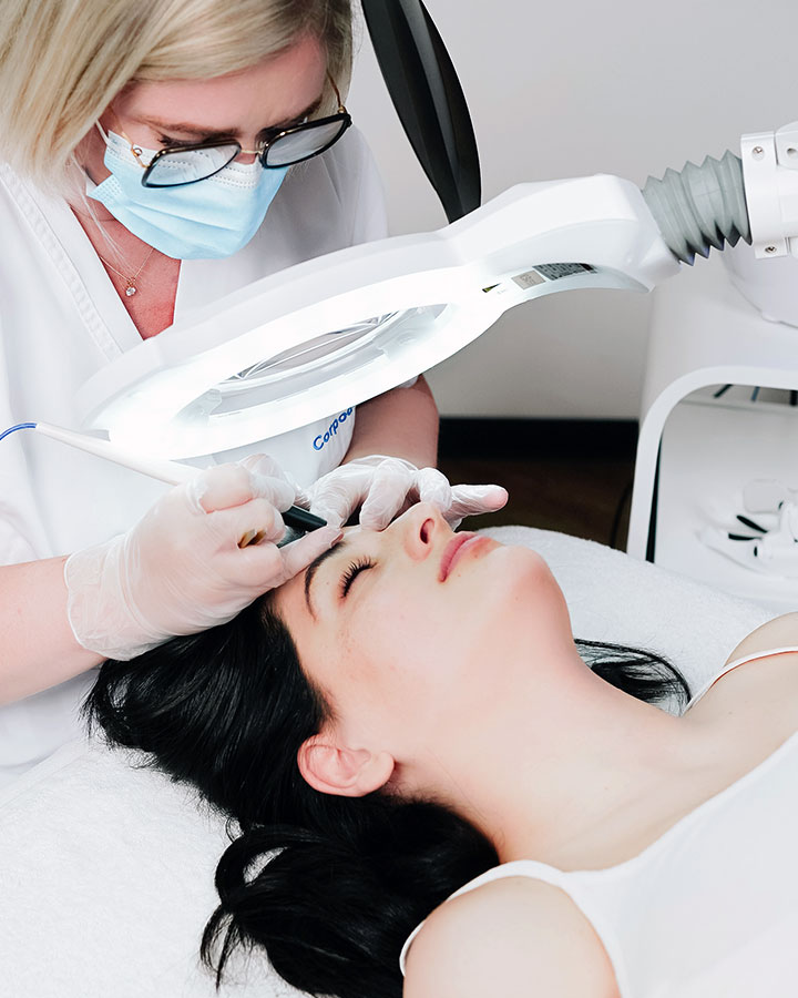 épilation par thermolyse du visage