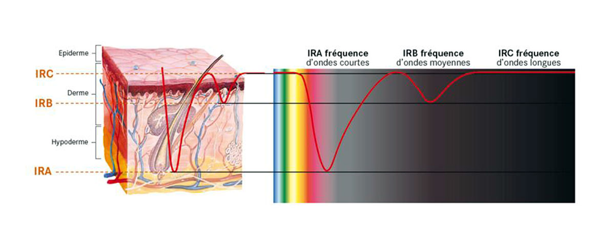 illustration de la profondeur de pénétration des infrarouges utilisés pour les soins esthétiques