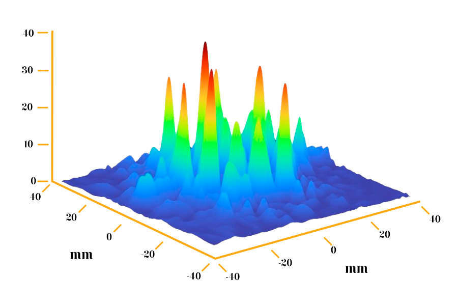 schéma action des ultrasons sur le derme et l'hypoderme volume traité 24cm3