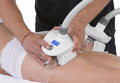 installation pièces à main cryoliplyse pli fessier