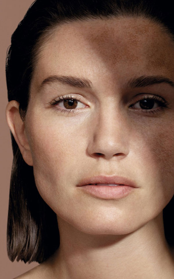 visuel mareting mesoestetic pour les soins dépigmentants