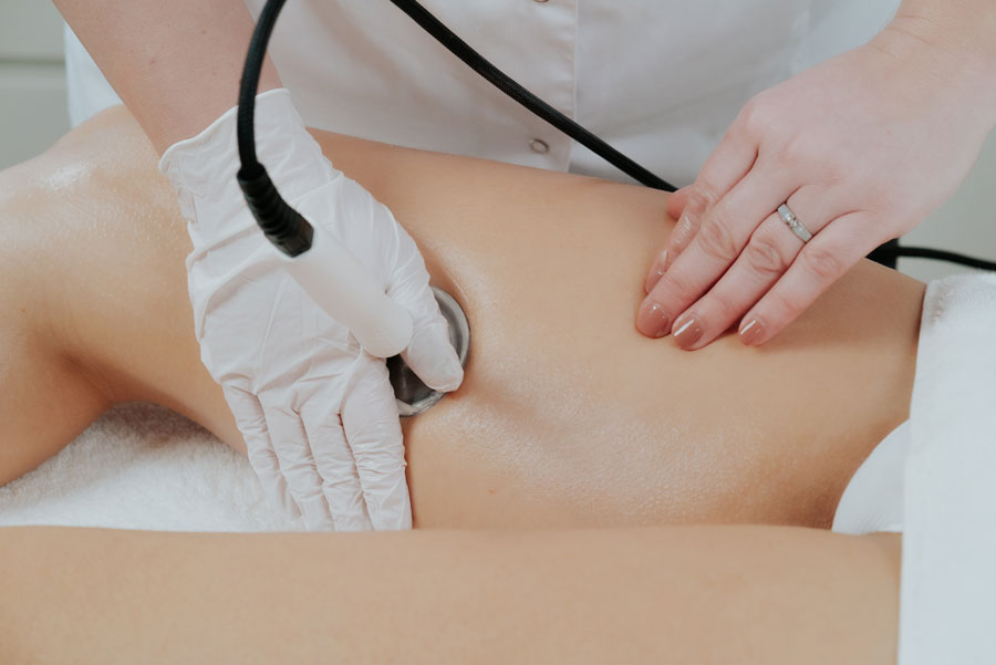 soin des cuisses par radiofréquence résistive