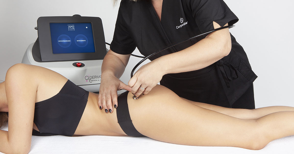 microdermabrasion corps avec Dermoregen