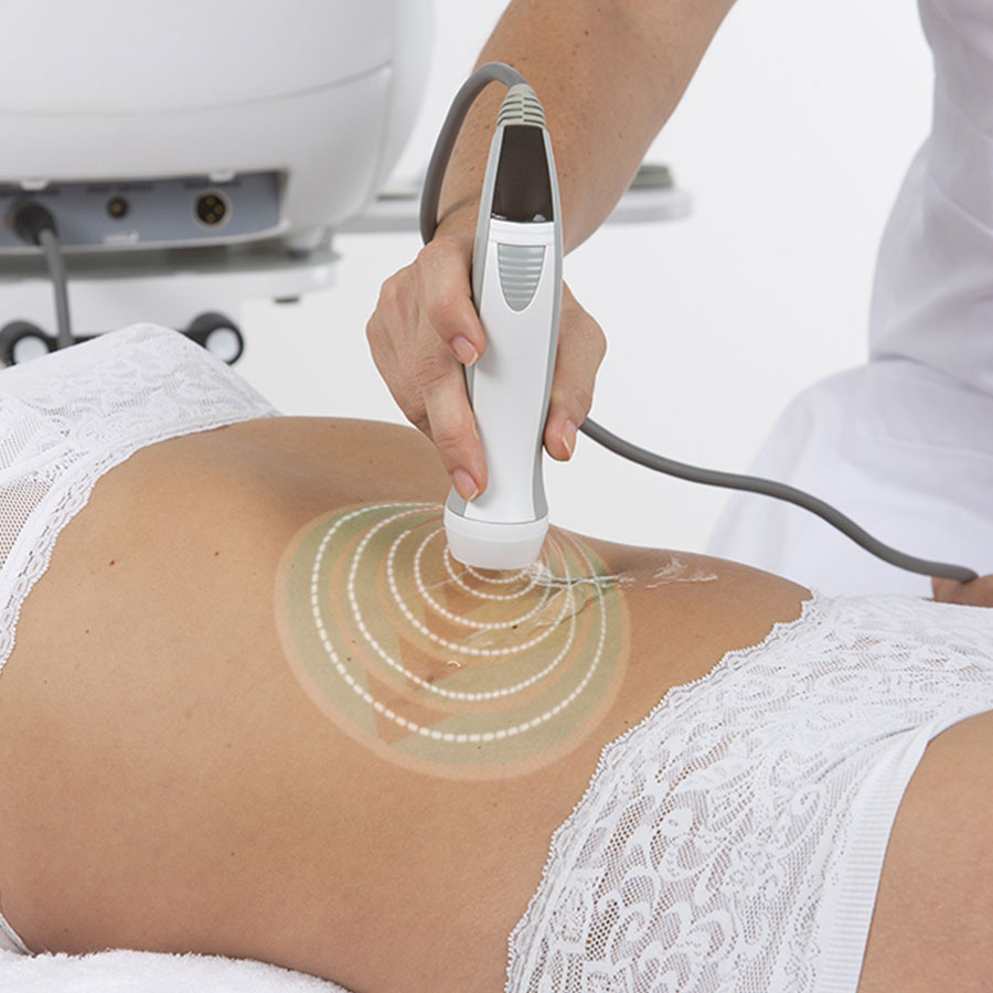 Raffermissement cutané du ventre avec l'appareil radiofréquence Unique