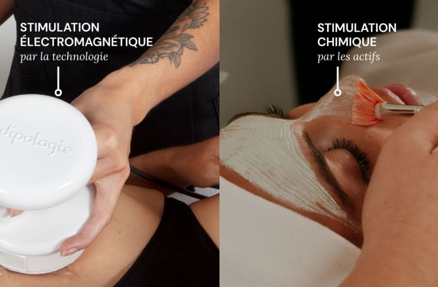 illustration des solutions de stimulation cellulaire en institut