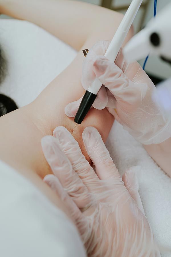 épilation définitive des aisselles en institut