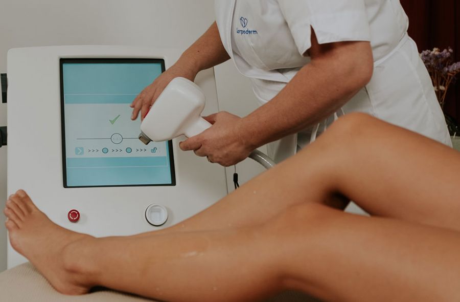 séance épilation au laser avec leaseir