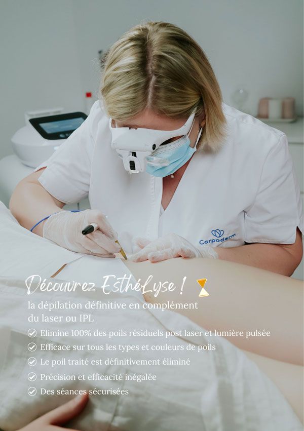 affiche promotion épilation électrique
