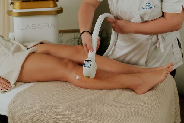 épilation laser avec Lasera