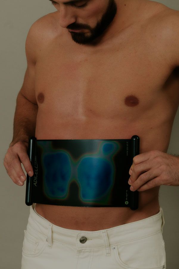 repérage adiposité abdomen avec une plaque thermographique souple