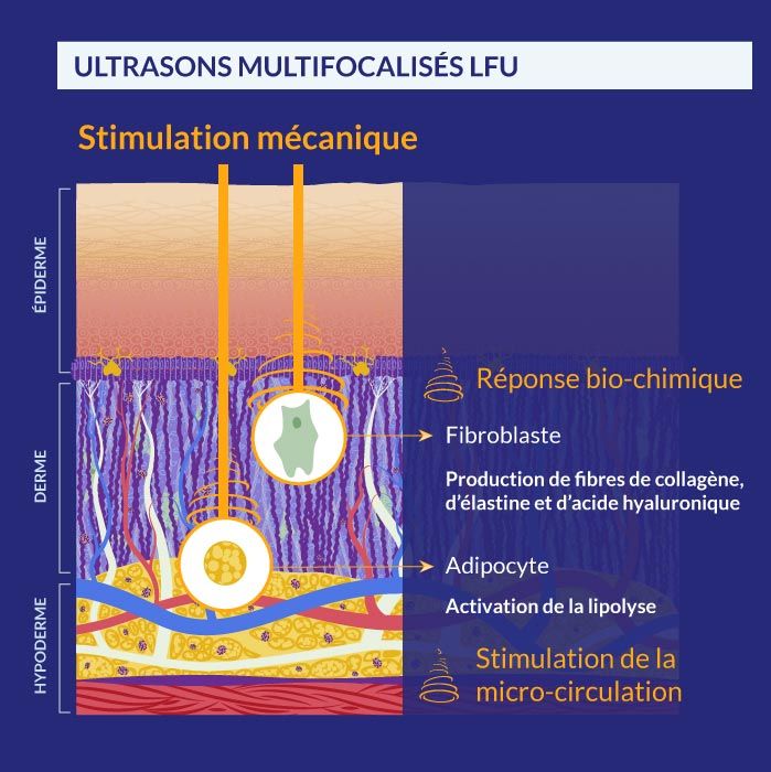 illustration du mécanisme de mécanotransduction à l'oeuvre dans les soins ultrasons esthétiques