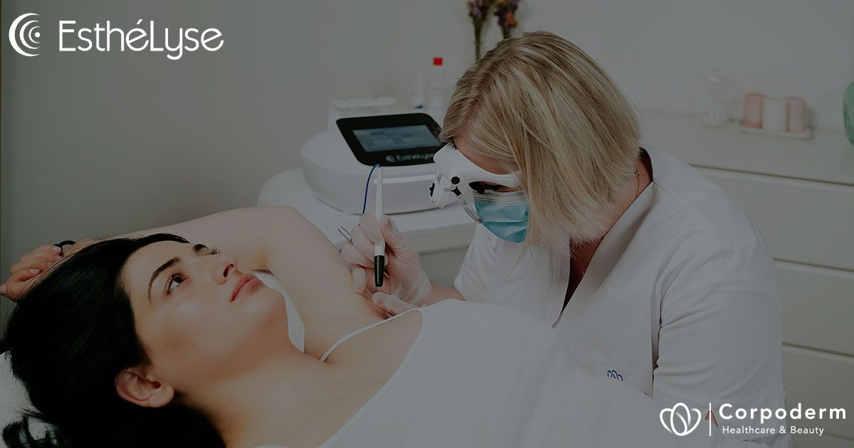 épilation haute fréquence par thermolyse en institut avec EsthéLyse